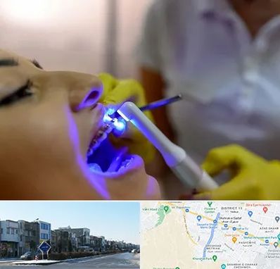 دندانپزشکی با لیزر در شریعتی مشهد