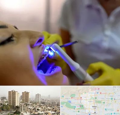 دندانپزشکی با لیزر در منطقه 5 تهران