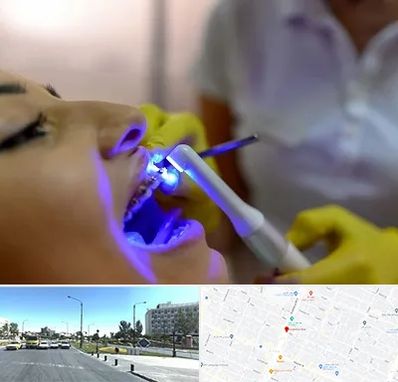 دندانپزشکی با لیزر در بلوار کلاهدوز مشهد