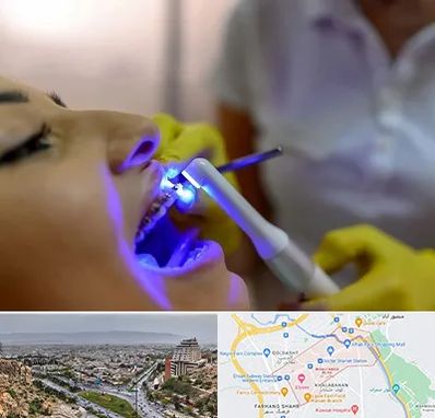 دندانپزشکی با لیزر در معالی آباد شیراز