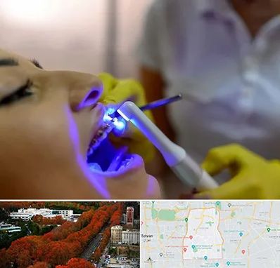 دندانپزشکی با لیزر در منطقه 6 تهران