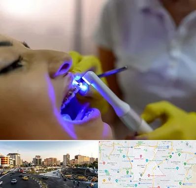 دندانپزشکی با لیزر در منطقه 7 تهران