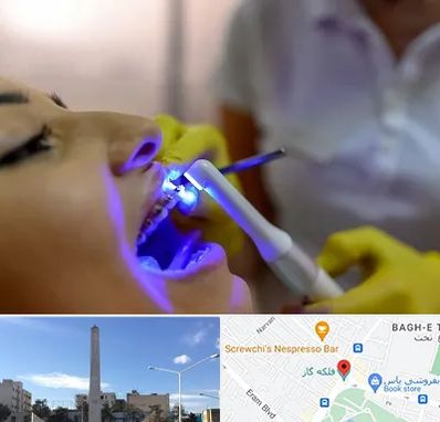 دندانپزشکی با لیزر در فلکه گاز شیراز