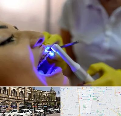 دندانپزشکی با لیزر در منطقه 11 تهران
