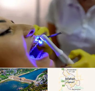 دندانپزشکی با لیزر در اصفهان