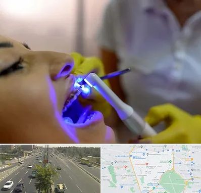 دندانپزشکی با لیزر در منطقه 17 تهران