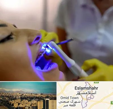 دندانپزشکی با لیزر در اسلامشهر