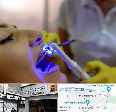 دندانپزشکی با لیزر در منیریه 