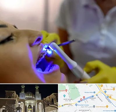 دندانپزشکی با لیزر در زرگری شیراز