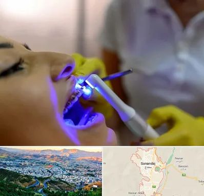 دندانپزشکی با لیزر در سنندج