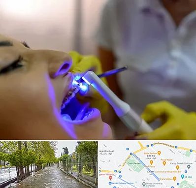 دندانپزشکی با لیزر در خیابان ارم شیراز