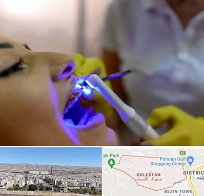 دندانپزشکی با لیزر در شهرک گلستان شیراز