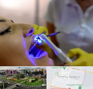 دندانپزشکی با لیزر در تهرانسر 