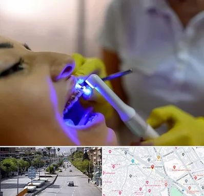دندانپزشکی با لیزر در خیابان زند شیراز