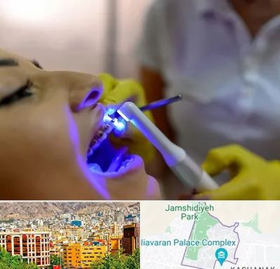 دندانپزشکی با لیزر در نیاوران 