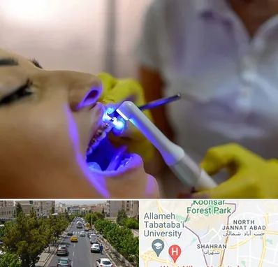 دندانپزشکی با لیزر در شهران 