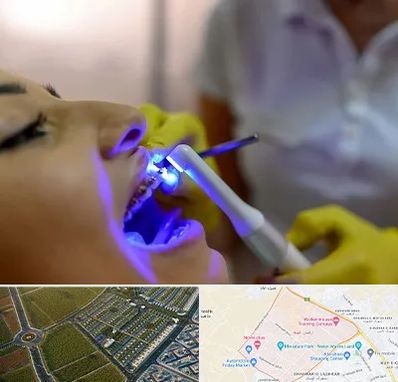 دندانپزشکی با لیزر در الهیه مشهد