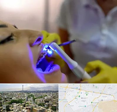 دندانپزشکی با لیزر در منطقه 8 تهران