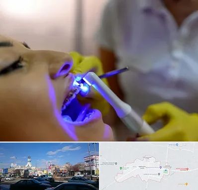 دندانپزشکی با لیزر در ماهدشت کرج