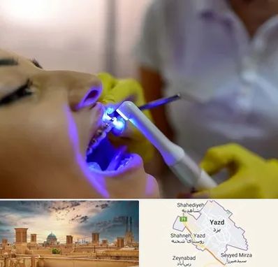 دندانپزشکی با لیزر در یزد