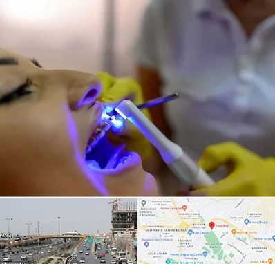 دندانپزشکی با لیزر در بلوار توس مشهد