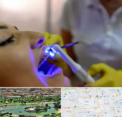 دندانپزشکی با لیزر در منطقه 9 تهران