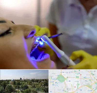 دندانپزشکی با لیزر در منطقه 16 تهران