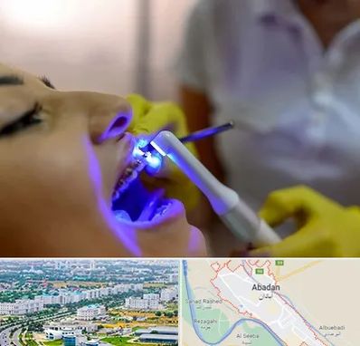 دندانپزشکی با لیزر در آبادان
