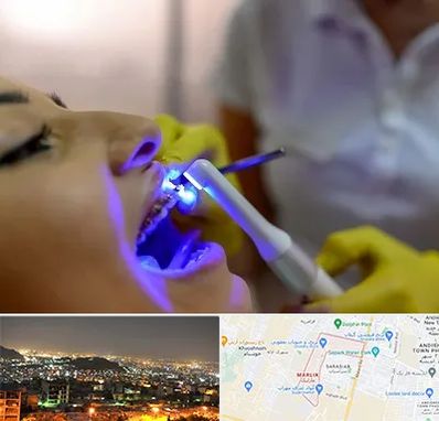 دندانپزشکی با لیزر در مارلیک کرج
