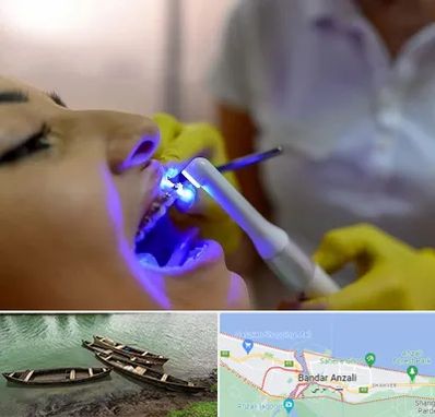 دندانپزشکی با لیزر در بندر انزلی