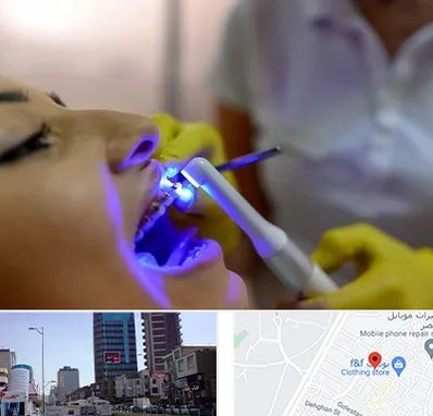 دندانپزشکی با لیزر در چهارراه طالقانی کرج