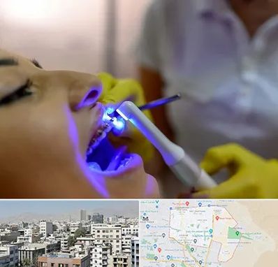 دندانپزشکی با لیزر در منطقه 14 تهران
