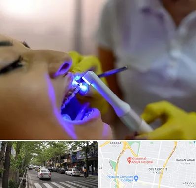 دندانپزشکی با لیزر در ظفر 