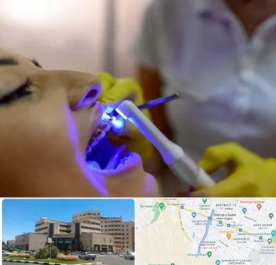 دندانپزشکی با لیزر در صیاد شیرازی مشهد