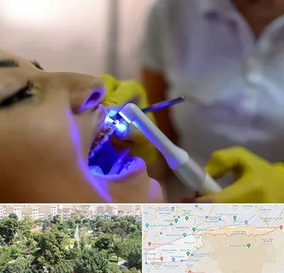 دندانپزشکی با لیزر در منطقه 13 تهران