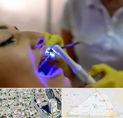 دندانپزشکی با لیزر در قاسم آباد مشهد