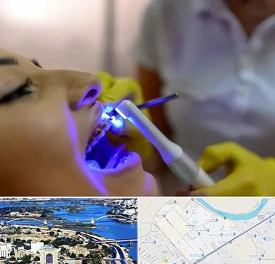 دندانپزشکی با لیزر در کوروش اهواز