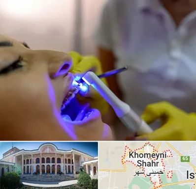 دندانپزشکی با لیزر در خمینی شهر