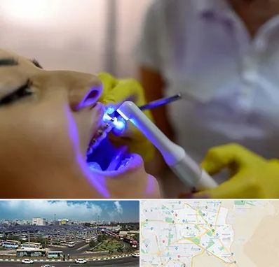 دندانپزشکی با لیزر در منطقه 15 تهران