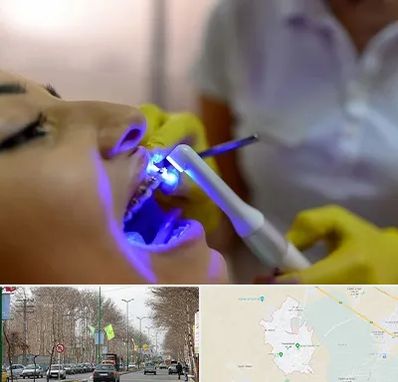 دندانپزشکی با لیزر در نظرآباد کرج