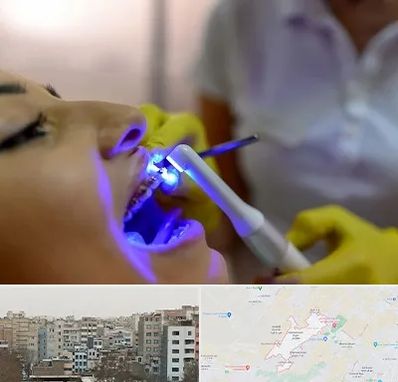 دندانپزشکی با لیزر در محمد شهر کرج
