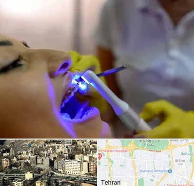دندانپزشکی با لیزر در مرزداران 