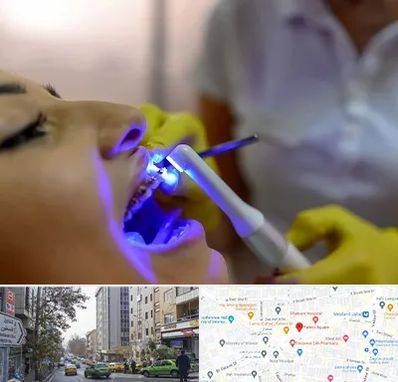 دندانپزشکی با لیزر در فاطمی