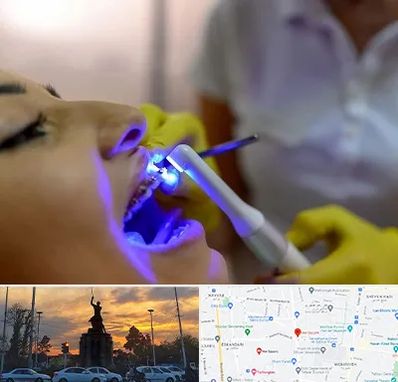 دندانپزشکی با لیزر در میدان حر