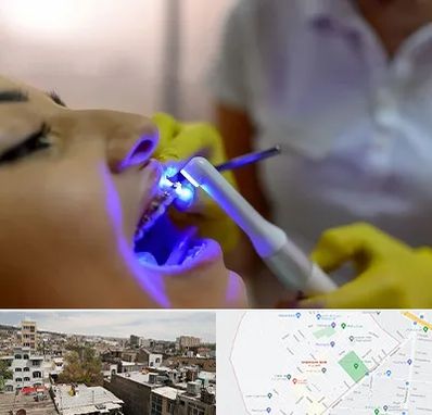 دندانپزشکی با لیزر در شمیران نو