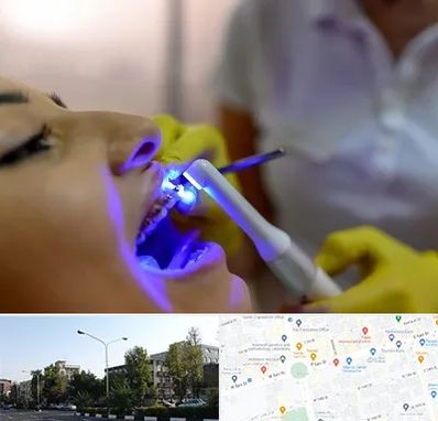 دندانپزشکی با لیزر در میدان کاج