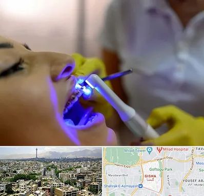 دندانپزشکی با لیزر در گیشا 