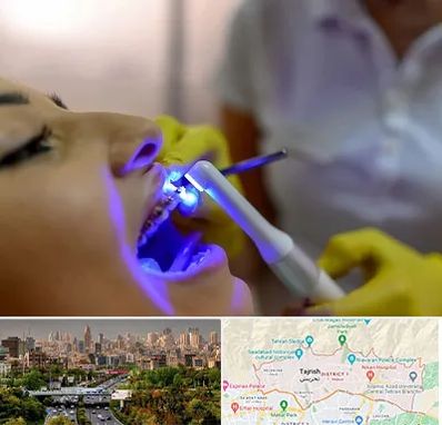 دندانپزشکی با لیزر در منطقه 1 تهران