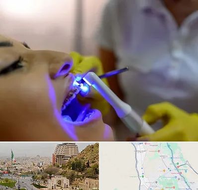 دندانپزشکی با لیزر در فرهنگ شهر شیراز