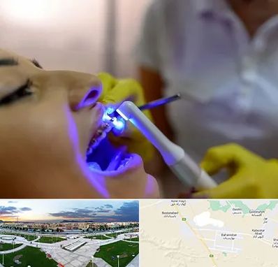دندانپزشکی با لیزر در بهارستان اصفهان
